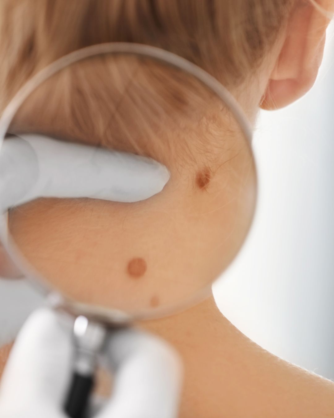 Questions de patients en dermatologie